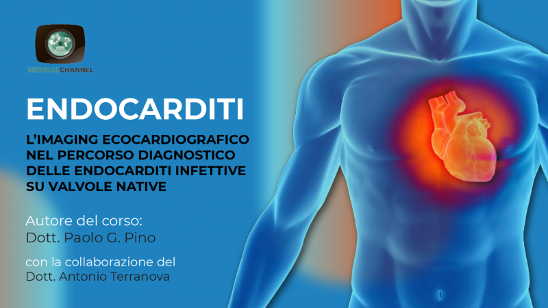 Endocarditi. L’imaging ecocardiografico nel percorso diagnostico delle endocarditi delle valvole native